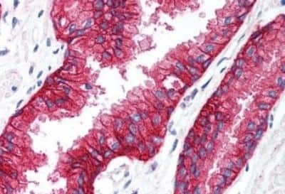 Immunohistochemistry-Paraffin: KCNN4 Antibody [NBP3-14383] - Immunohistochemistry of formalin-fixed, paraffin-embedded human prostate after heat-induced antigen retrieval.